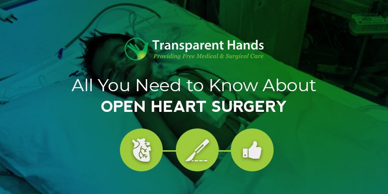 All You Need to Know About Open Heart Surgery